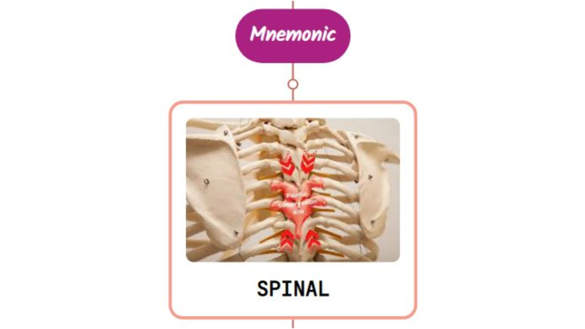 You are currently viewing Spondylosis Important Facts : Mnemonics