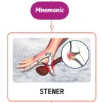 Read more about the article Stener Lesion : Mnemonics [NEVER FORGET AGAIN]