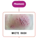 Read more about the article African Trypanosomiasis Rash Mnemonic : [NEVER FORGET AGAIN]
