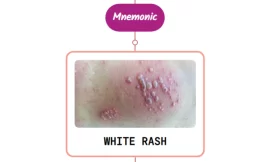 African Trypanosomiasis Rash Mnemonic : [NEVER FORGET AGAIN]