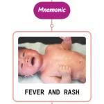 Read more about the article Approach To A Patient With Fever & Rash : Mnemonic