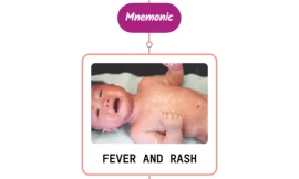 Approach To A Patient With Fever & Rash : Mnemonic