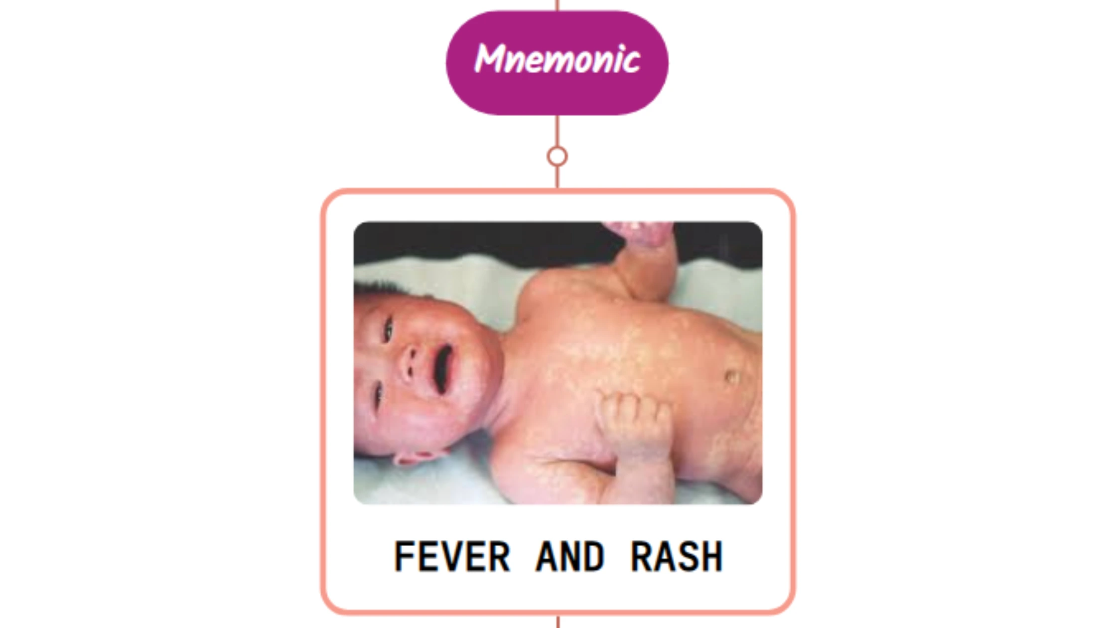 You are currently viewing Approach To A Patient With Fever & Rash : Mnemonic