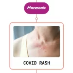 Read more about the article COVID-19 Rash Mnemonic : [NEVER FORGET AGAIN]
