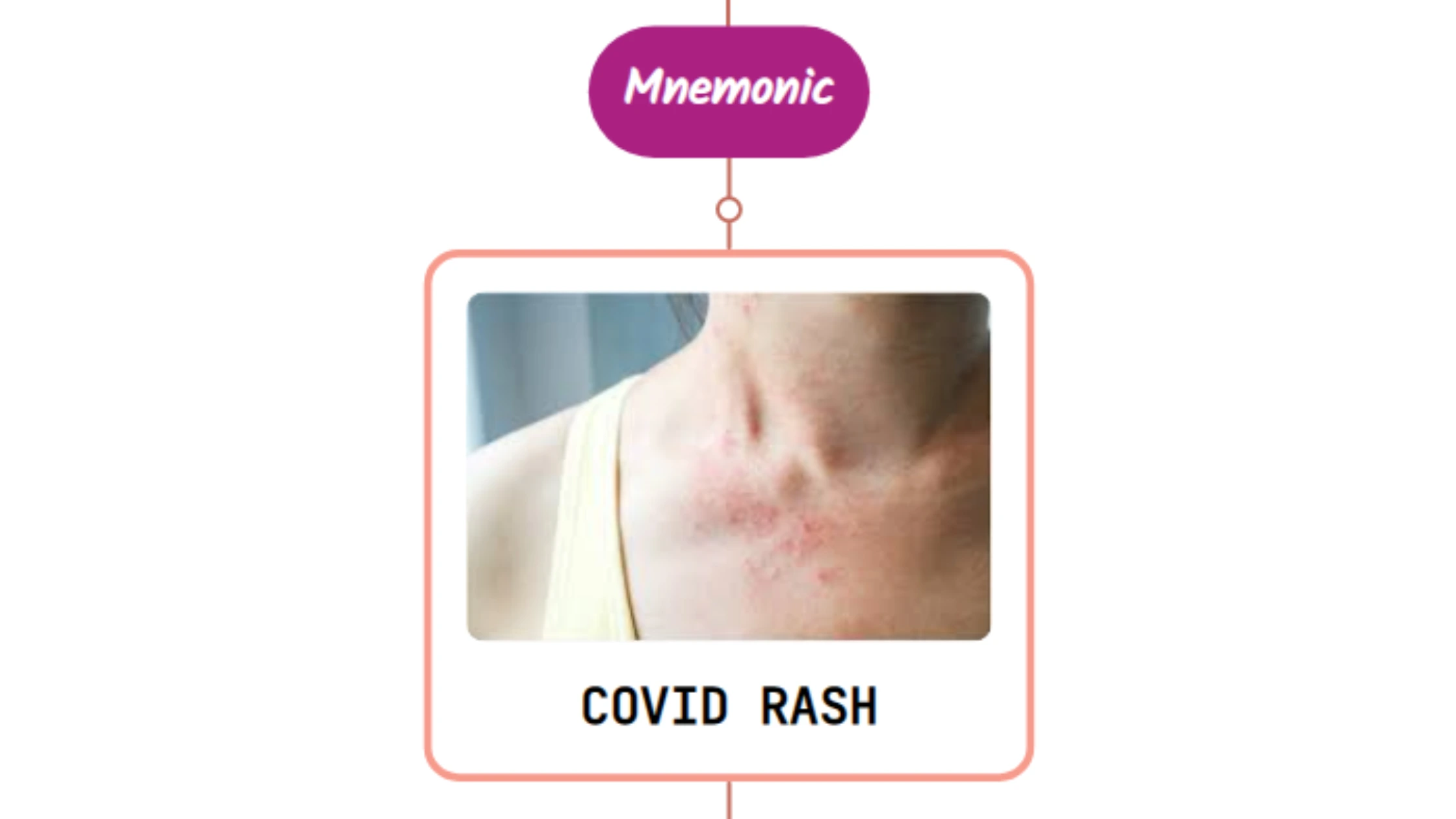 You are currently viewing COVID-19 Rash Mnemonic : [NEVER FORGET AGAIN]