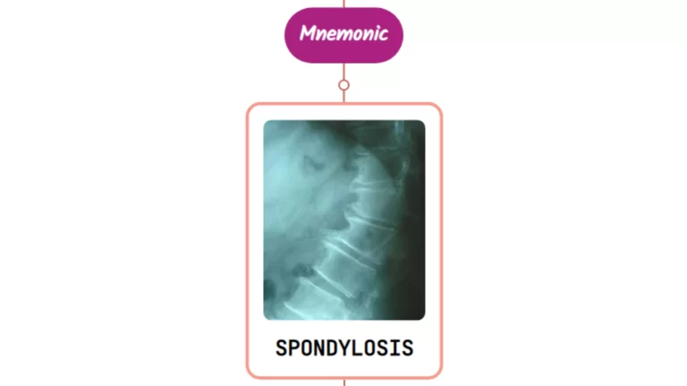 Read more about the article Cervical Spondylosis : Mnemonic