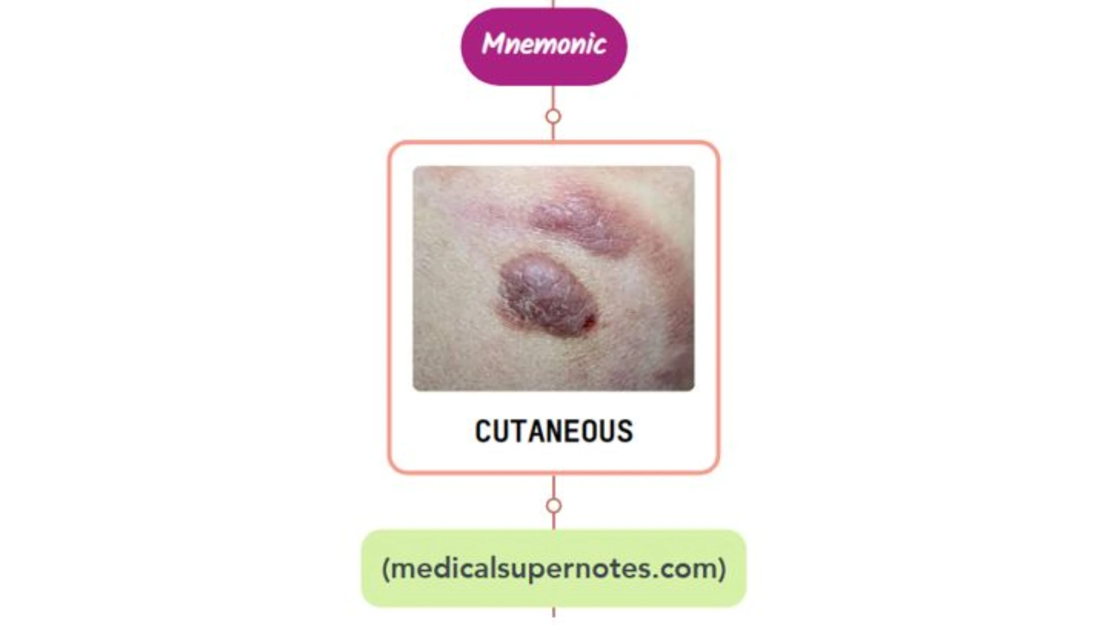 You are currently viewing Cutaneous Small Vessel Vasculitis Rash Mnemonic