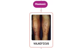 Disseminated Vibrio Vulnificus Infection Rash : Mnemonic