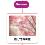 Read more about the article Erythema Multiforme Rash Mnemonic : [NEVER FORGET AGAIN]