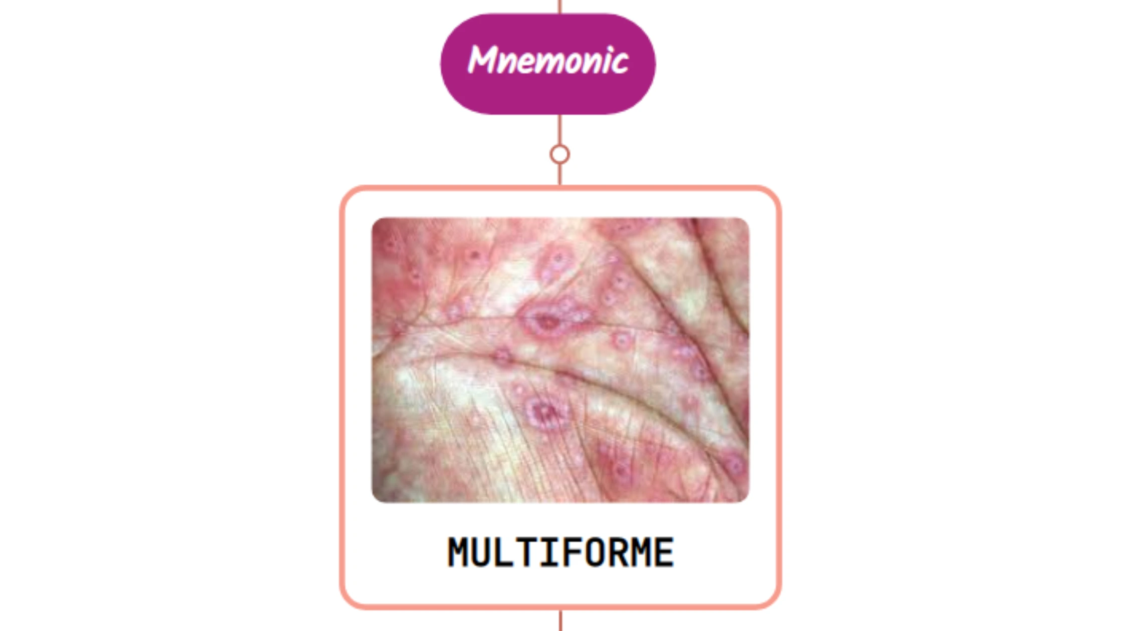 You are currently viewing Erythema Multiforme Rash Mnemonic : [NEVER FORGET AGAIN]