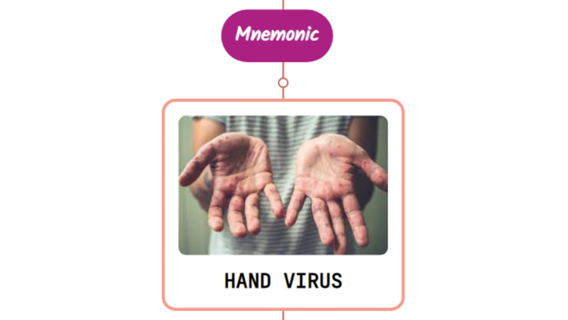You are currently viewing Hand Foot Mouth Disease Rash Mnemonic : [NEVER FORGET AGAIN]