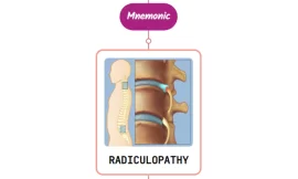 Low Back Pain With Radiculopathy Treatment : Mnemonics
