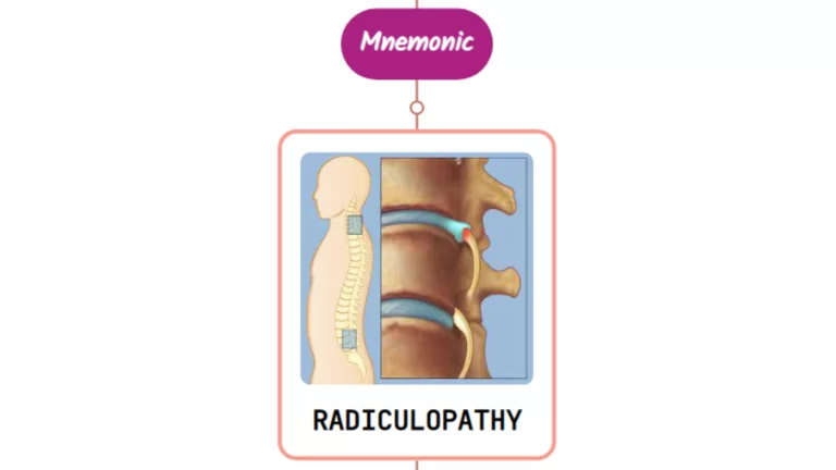 Read more about the article Low Back Pain With Radiculopathy Treatment : Mnemonics