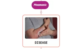 Lyme Disease Rash : Mnemonic [NEVER FORGET AGAIN]