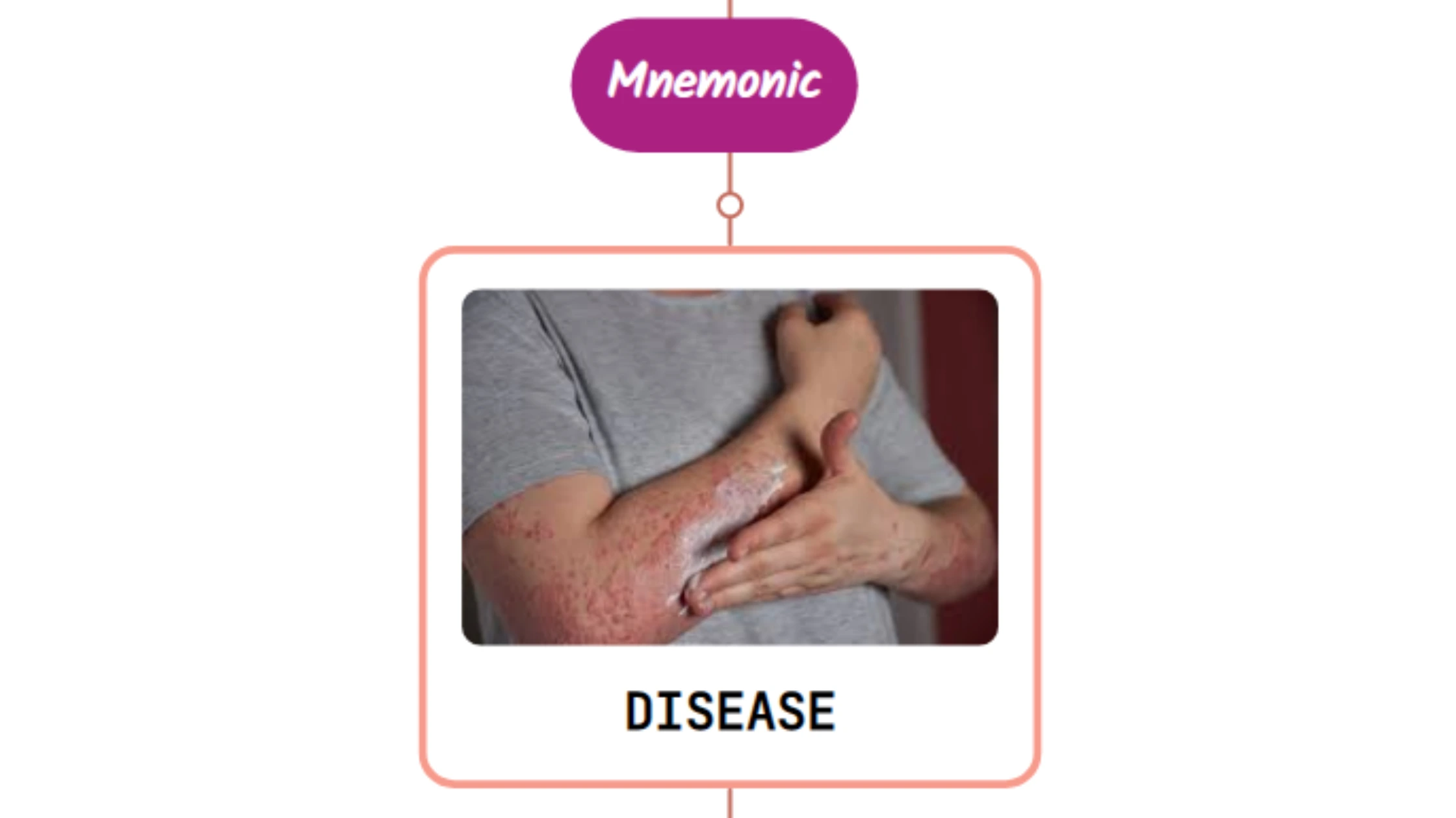 You are currently viewing Lyme Disease Rash : Mnemonic [NEVER FORGET AGAIN]