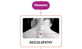 Neck Pain Without Radiculopathy : Mnemonic