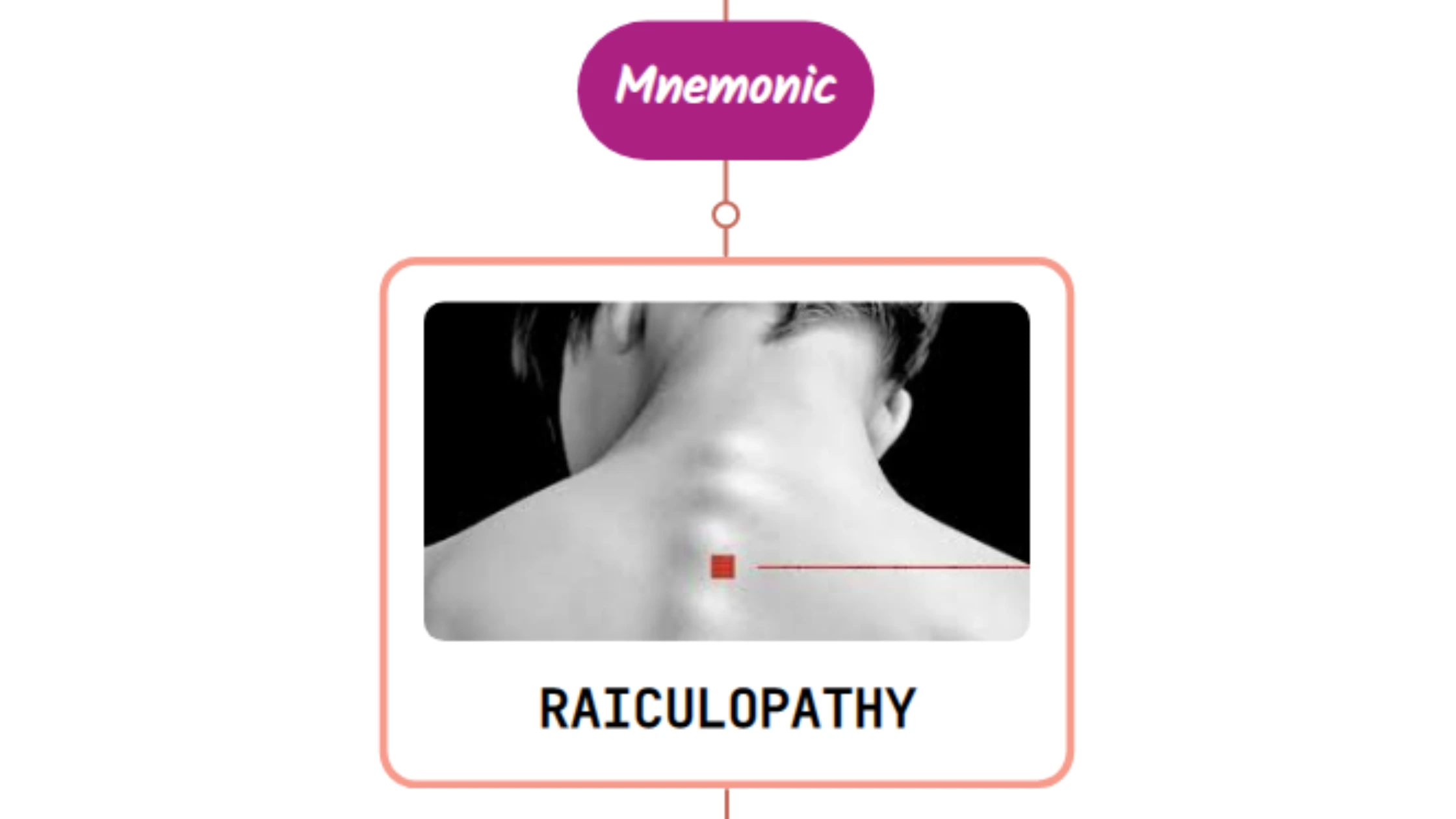 You are currently viewing Neck Pain Without Radiculopathy : Mnemonic