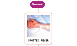 Rickettsial Spotted Fever Rash : Mnemonic [NEVER FORGET AGAIN]