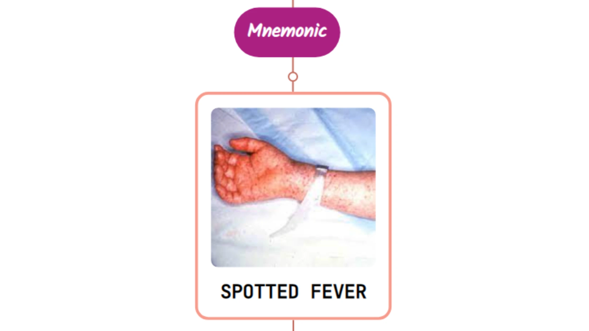 You are currently viewing Rickettsial Spotted Fever Rash : Mnemonic [NEVER FORGET AGAIN]