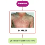 Read more about the article Scarlet Fever Rash Mnemonic : [NEVER FORGET AGAIN]