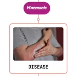 Read more about the article Still’s Disease Rash Mnemonic : [NEVER FORGET AGAIN]