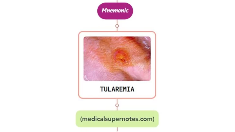 Read more about the article Tularemia Rash Mnemonic