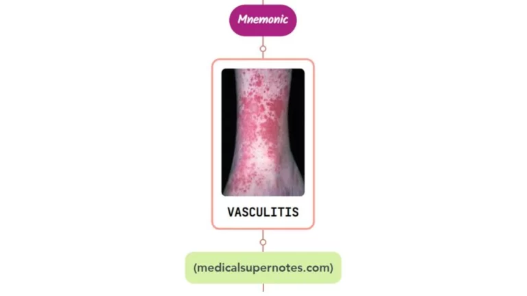 Read more about the article Urticarial Vasculitis Rash Mnemonic