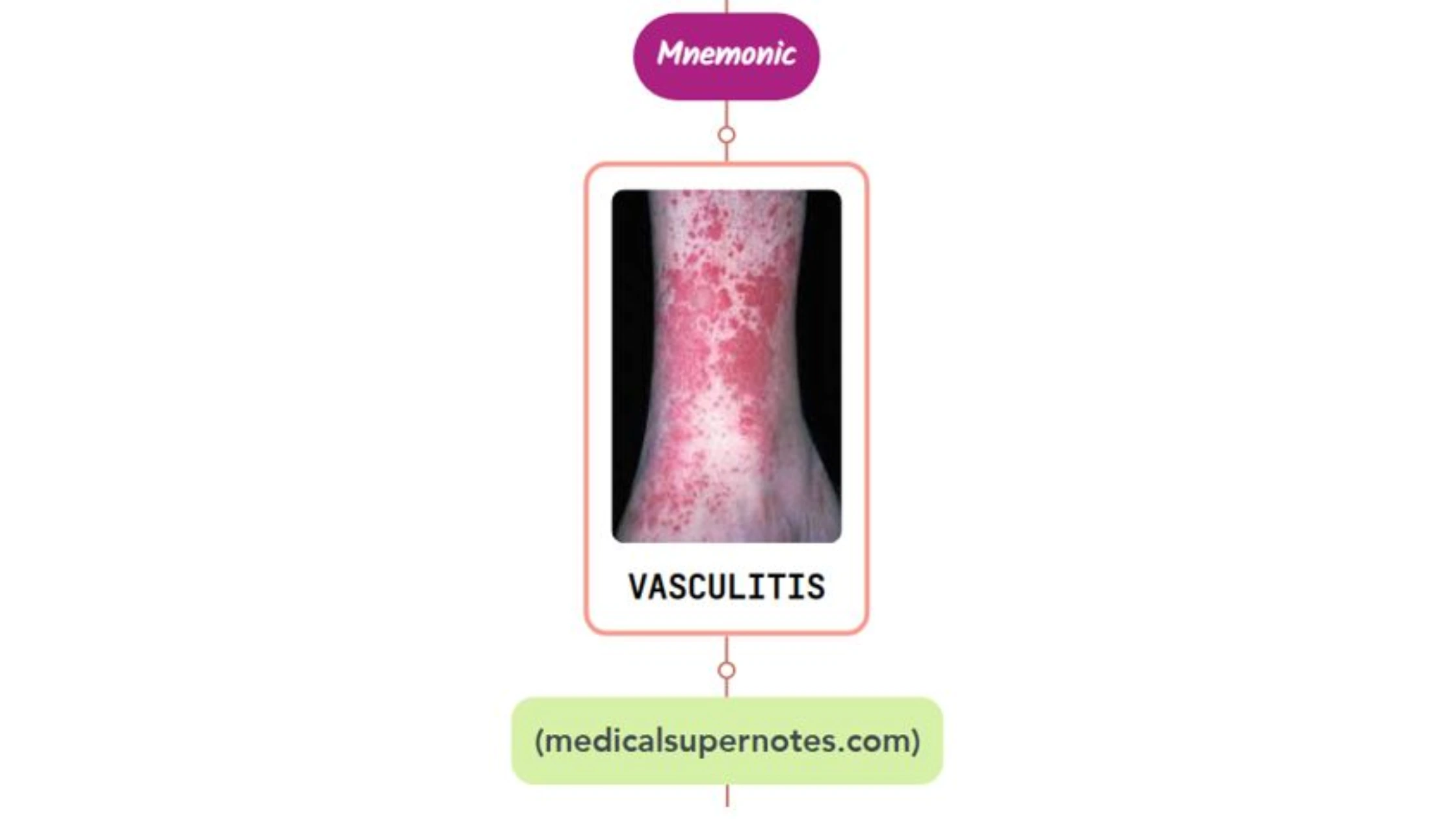 You are currently viewing Urticarial Vasculitis Rash Mnemonic
