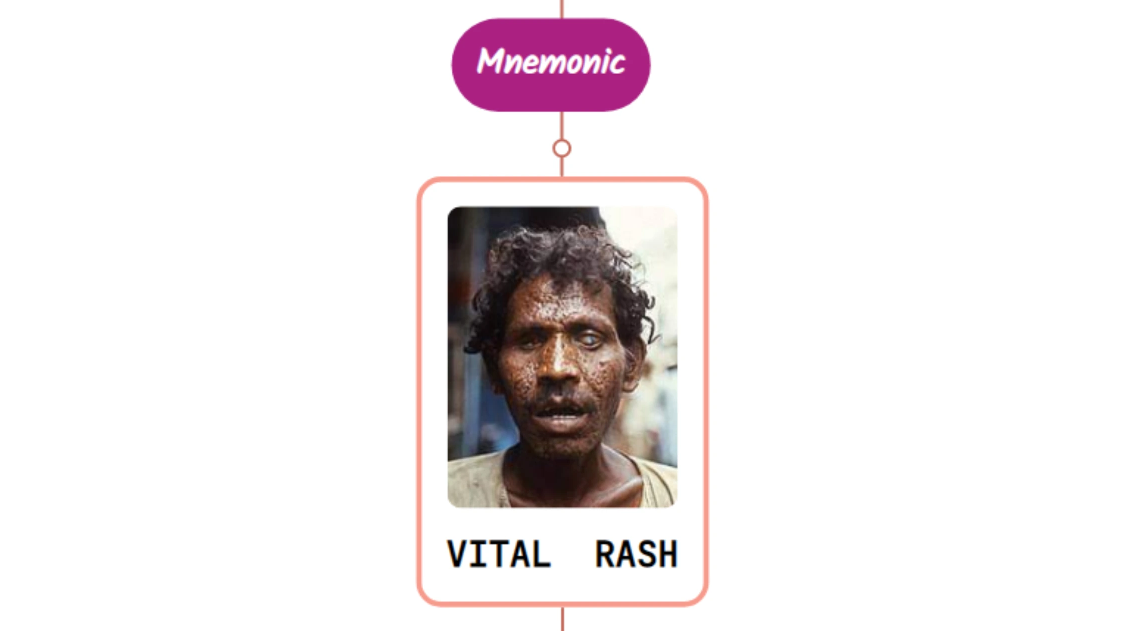 You are currently viewing Variola (smallpox) Rash : Mnemonic