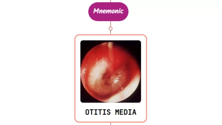 Read more about the article Acute Otitis Media Epidemiology & Etiology – Mnemonic