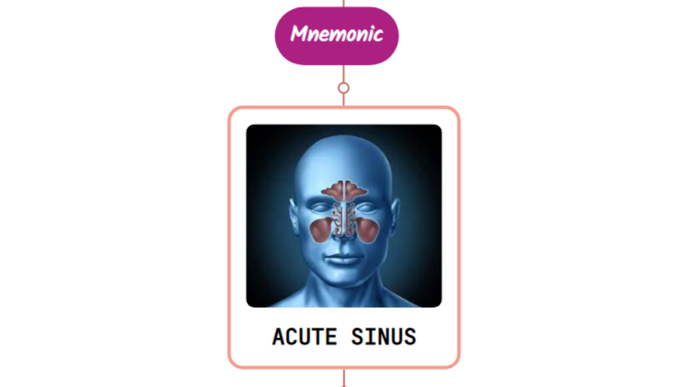 You are currently viewing Acute Sinusitis – Mnemonic