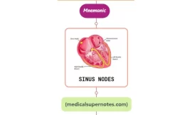 Cardiac Syncope Mnemonic