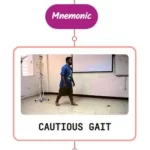 Read more about the article Cautious Gait Mnemonic