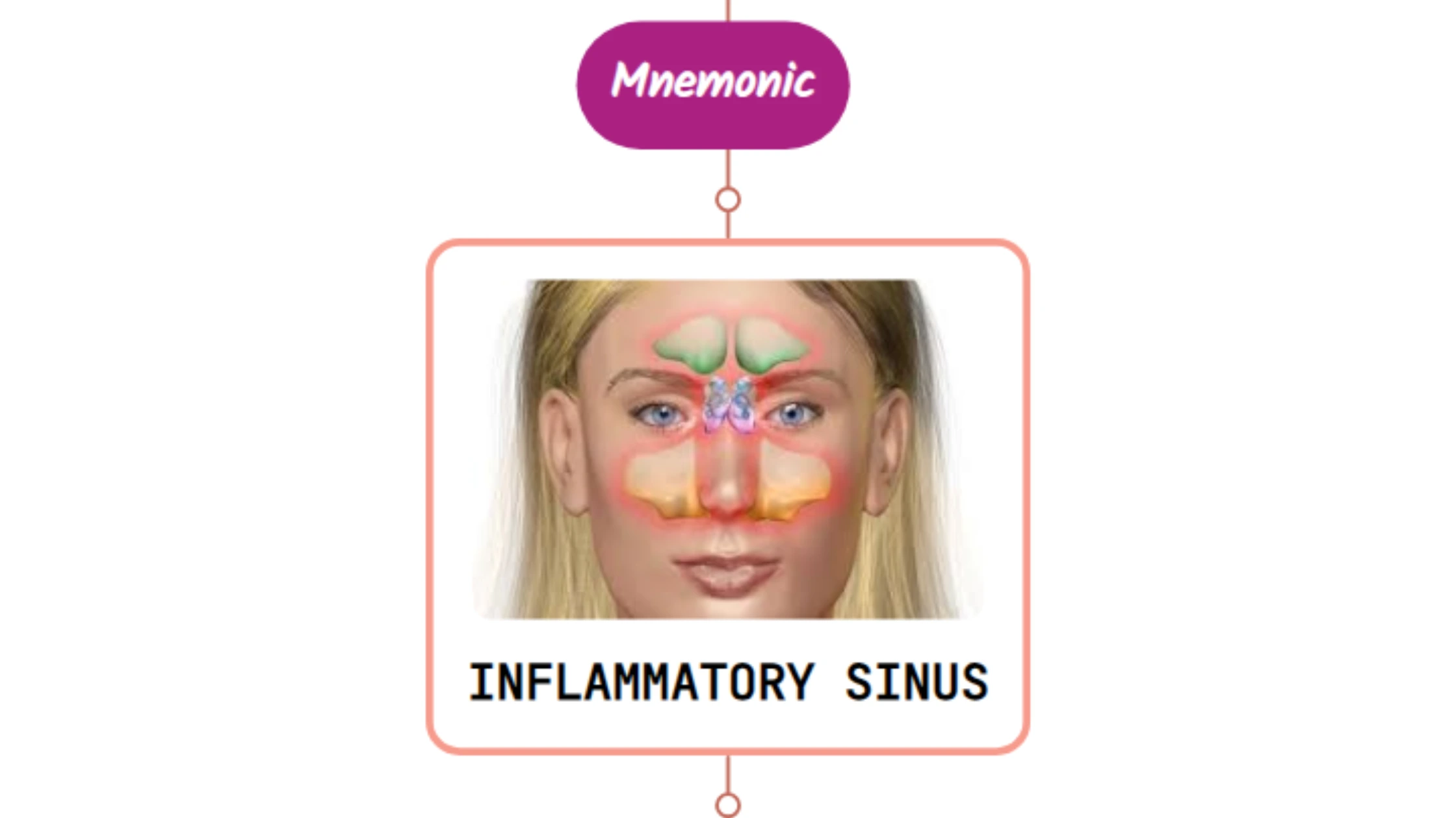 You are currently viewing Chronic Sinusitis – Mnemonic