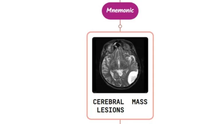 Read more about the article Coma Due to Cerebral Mass Lesions and Herniation Syndromes Mnemonic