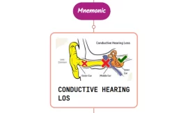 Conductive Hearing Loss – Mnemonic