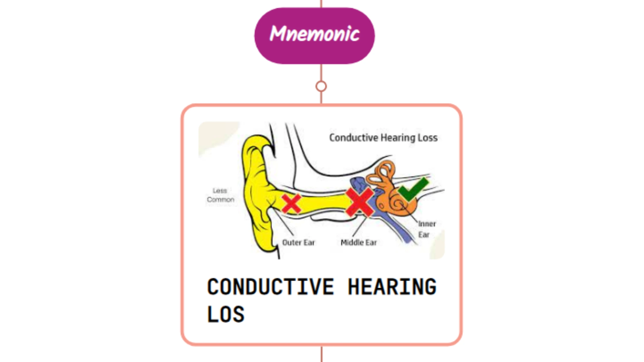 You are currently viewing Conductive Hearing Loss – Mnemonic