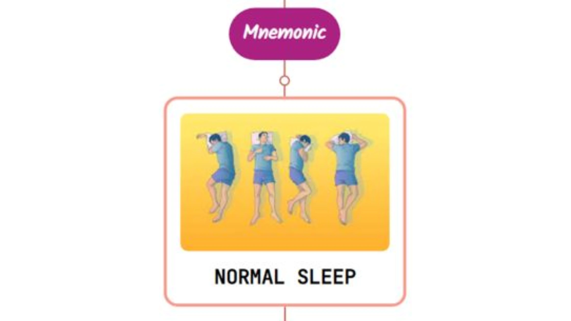You are currently viewing Delayed Sleep-Wake Phase Disorder Mnemonic