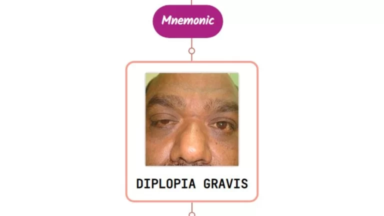 Read more about the article Diplopia In Myasthenia Gravis – Mnemonic