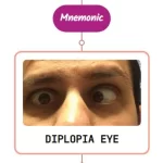 Read more about the article Double Vision (Diplopia) – Mnemonic