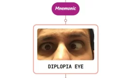 Double Vision (Diplopia) – Mnemonic