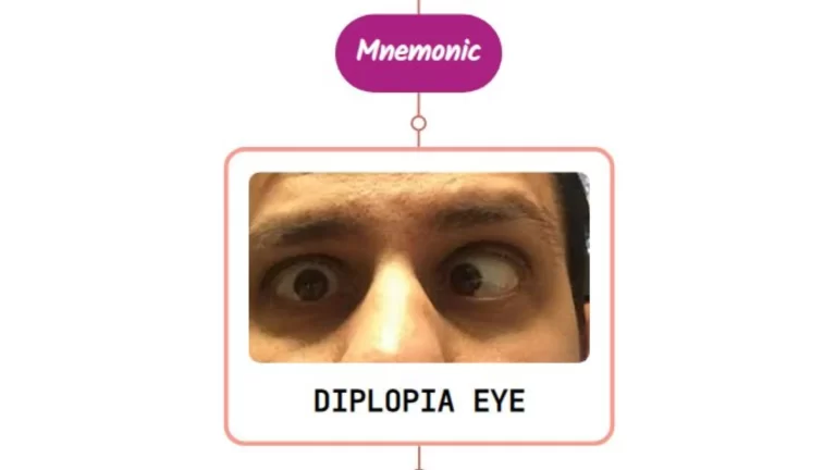 Read more about the article Double Vision (Diplopia) – Mnemonic