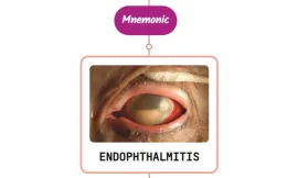 Endophthalmitis Mnemonic