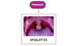 Epiglottitis – Mnemonic
