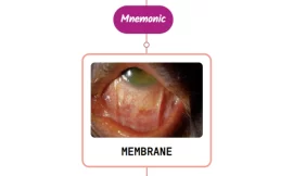 Epiretinal Membrane – Mnemonic
