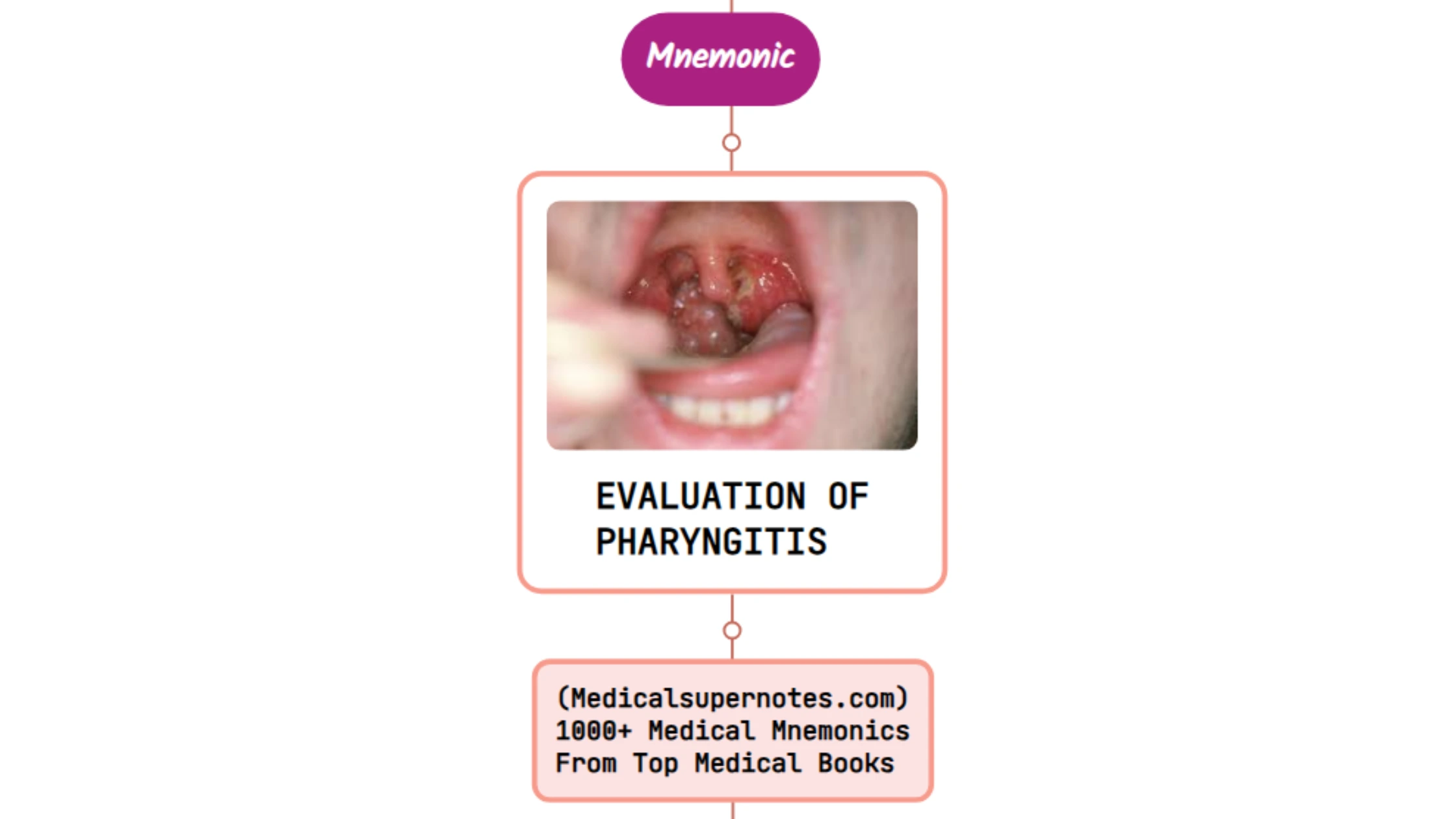 You are currently viewing Evaluation Of Streptococcal Pharyngitis – Mnemonic