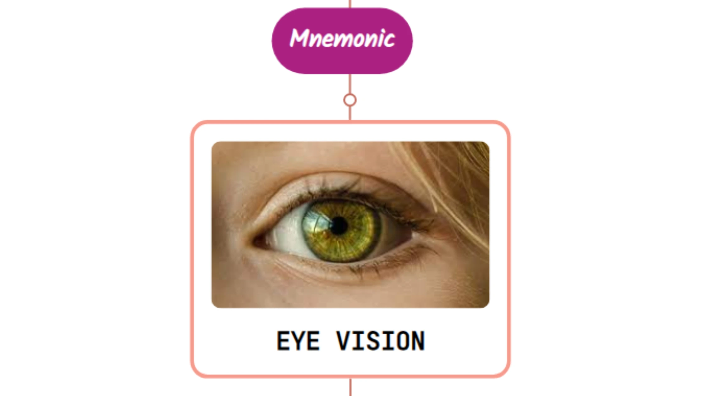 You are currently viewing Eye Symptoms In Classic Migraine – Mnemonic
