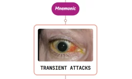 Eye Symptoms In Transient Ischemic Attacks – Mnemonic