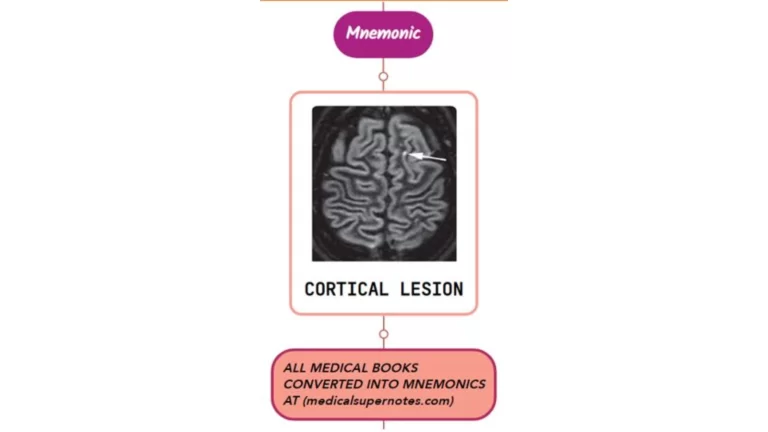 Read more about the article Hemiparesis Mnemonic