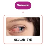 Read more about the article Herpes Zoster Infection In Eye Mnemonic